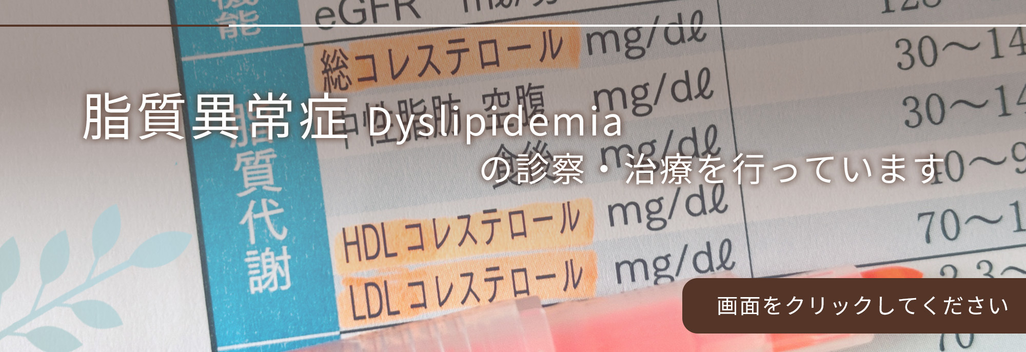 脂質異常症の診察・治療を行っています